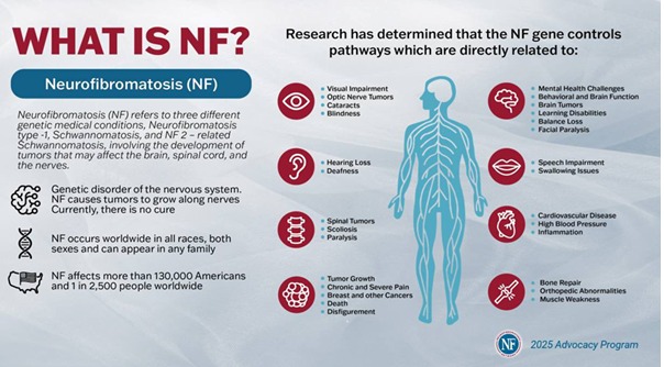 Neurofibromatoza: înțelegerea unei boli genetice rare și impactul ei asupra pacienților