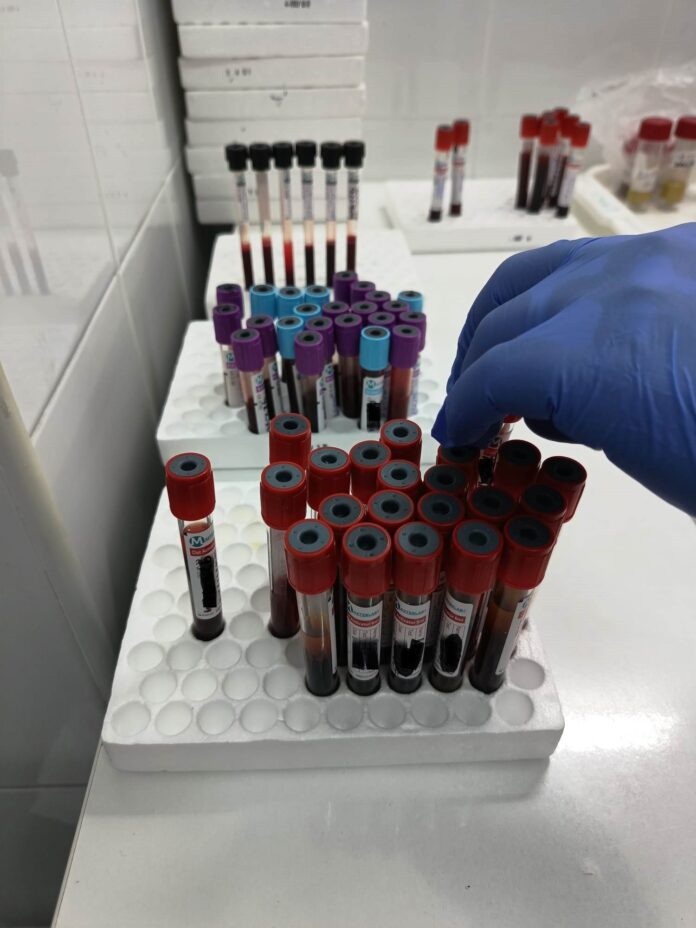 Gorjenii au acces la analize medicale gratuite – Iată cum poți beneficia de ele