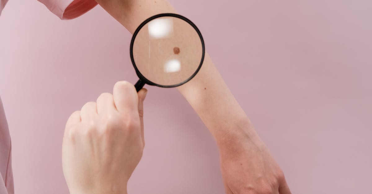 Legătura dintre obezitate și cancerul de colon: metode de prevenție și tratament