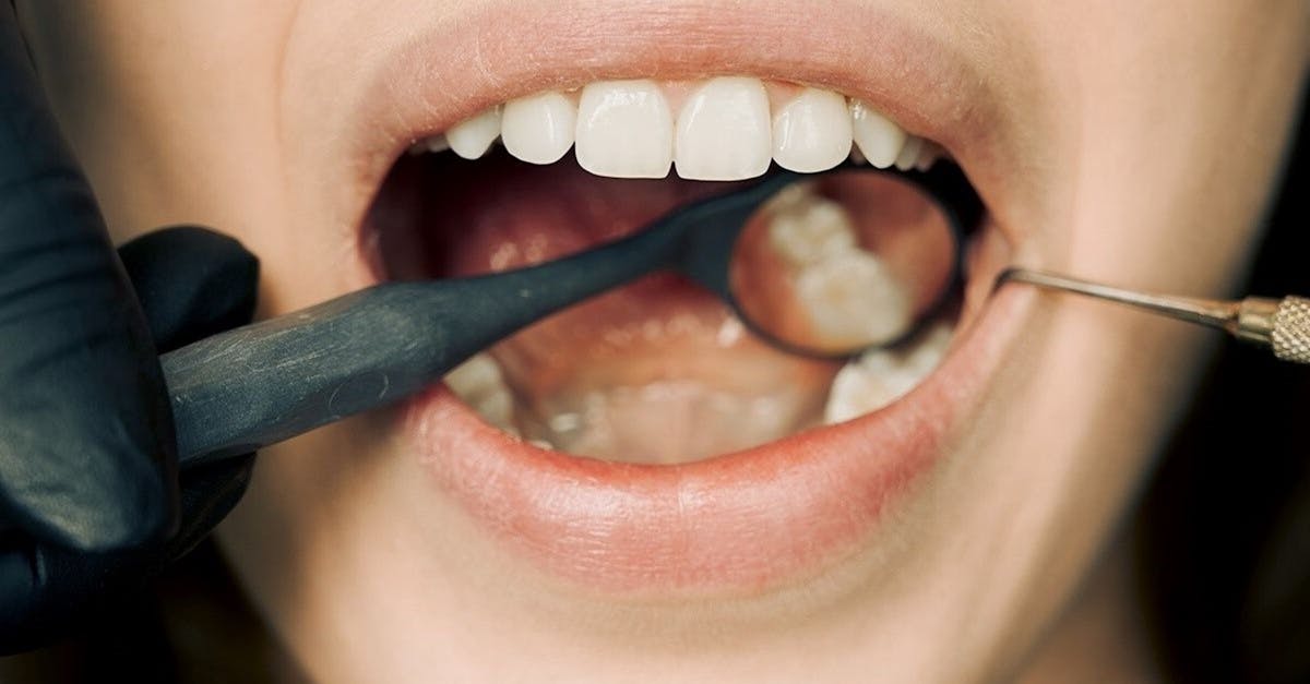 Frecvența recomandată pentru detartrajul dentar