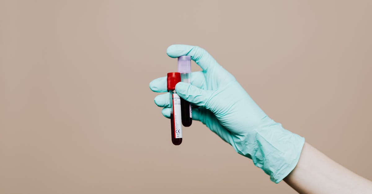 SUA aprobă primul test de sânge pentru depistarea bolii Alzheimer