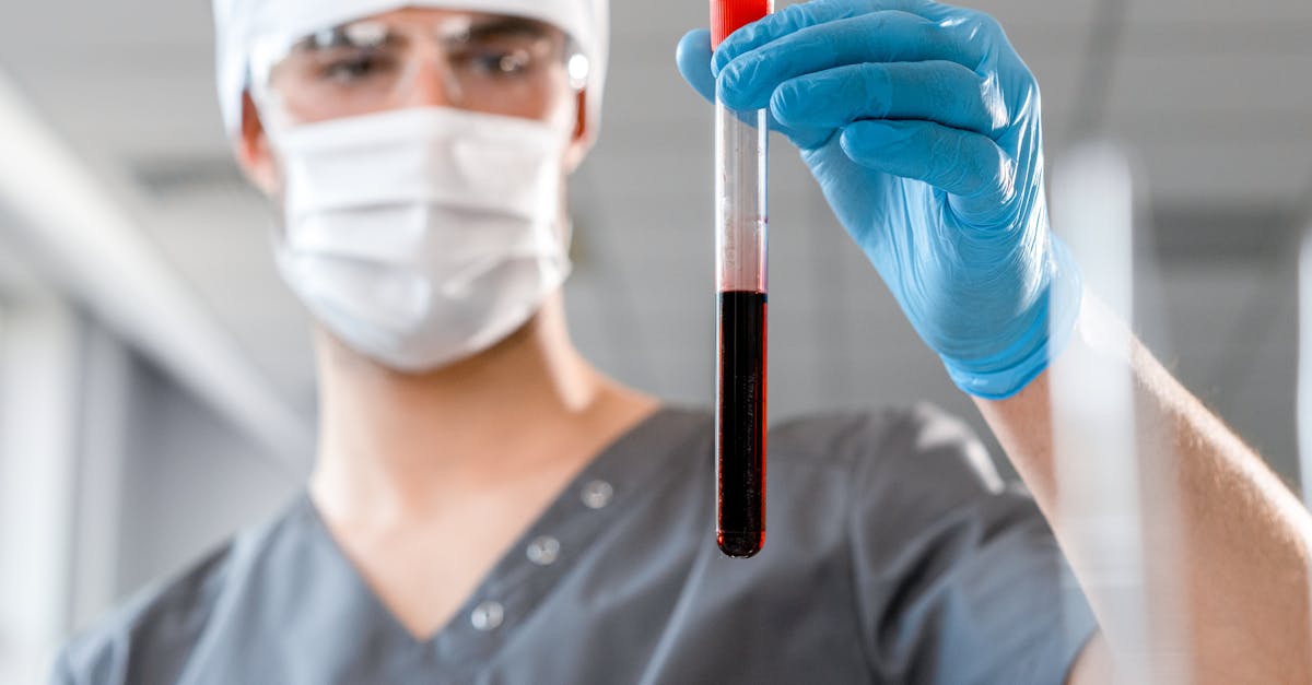 SUA aprobă primul test de sânge pentru depistarea bolii Alzheimer