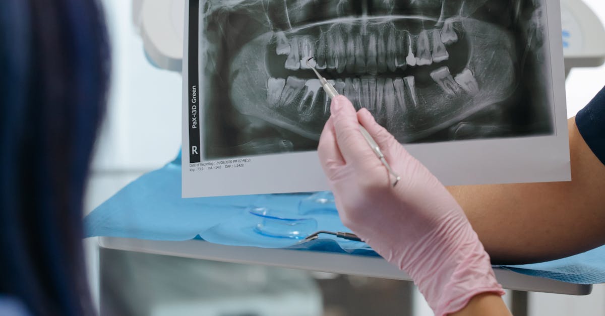 Statistici alarmante privind obiceiurile de igienă orală în România: sub 40% din populație vizitează stomatologul
