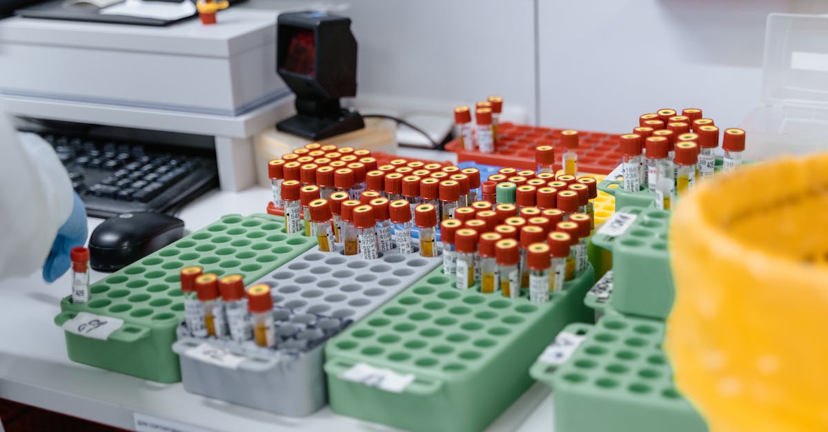 Un test de sânge promițător pentru detectarea Alzheimer cu o acuratețe de 95%
