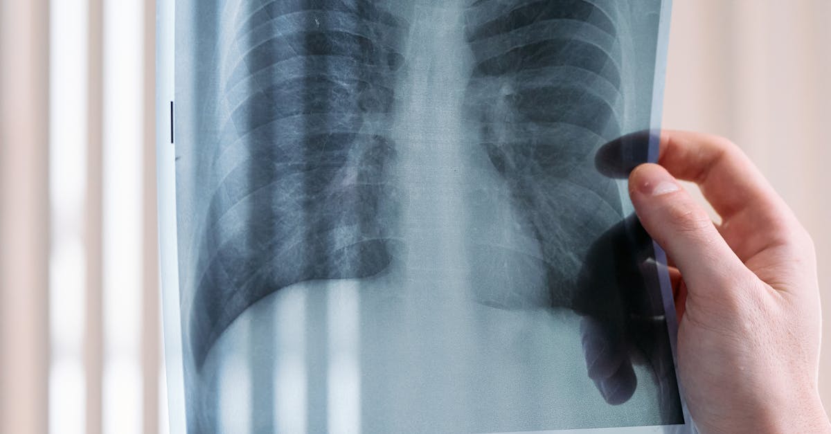 Ion Iliescu, fost președinte, diagnosticat cu cancer pulmonar