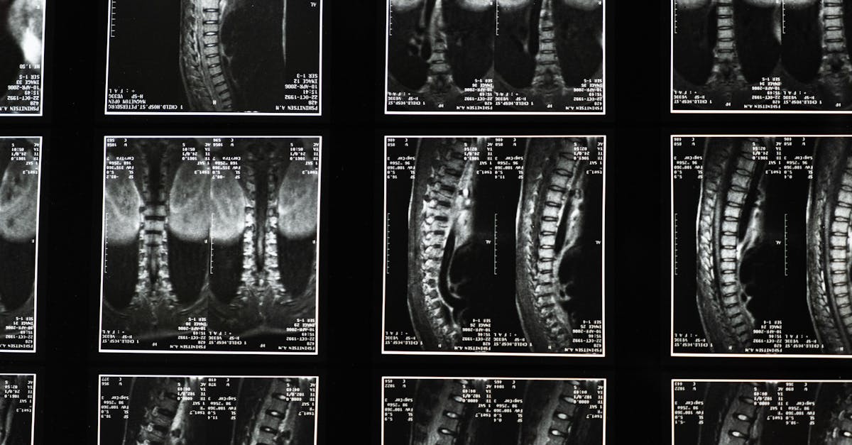 Confuzie majoră: Leon Dănăilă, neurochirurg de renume, infirmă zvonul morții
