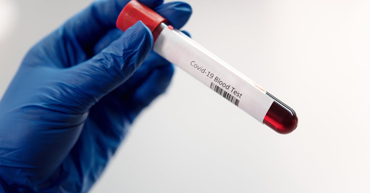 Test de sânge inovator detectează cancerul cu ani înainte de diagnosticare