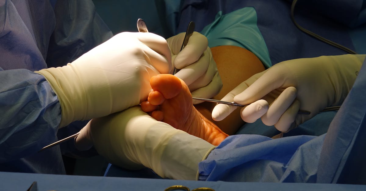 Echipa medicală din Timișoara salvează vieți prin tratamente avansate pentru pacienți cu arsuri severe