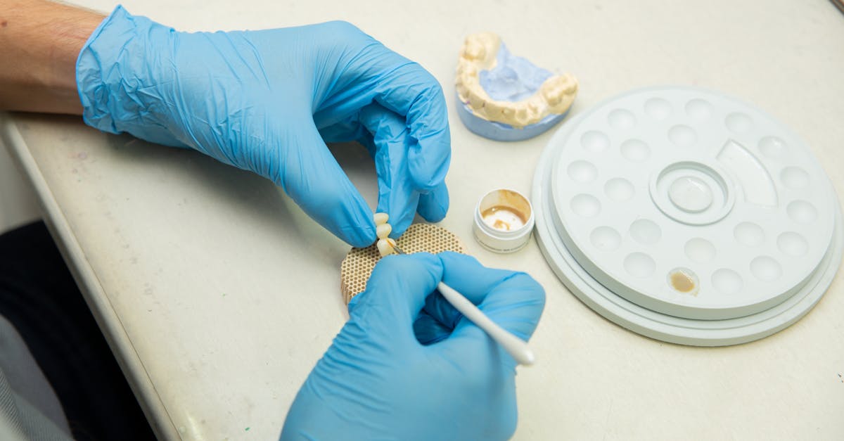 Ce trebuie să știi despre vindecarea după extracția dentară