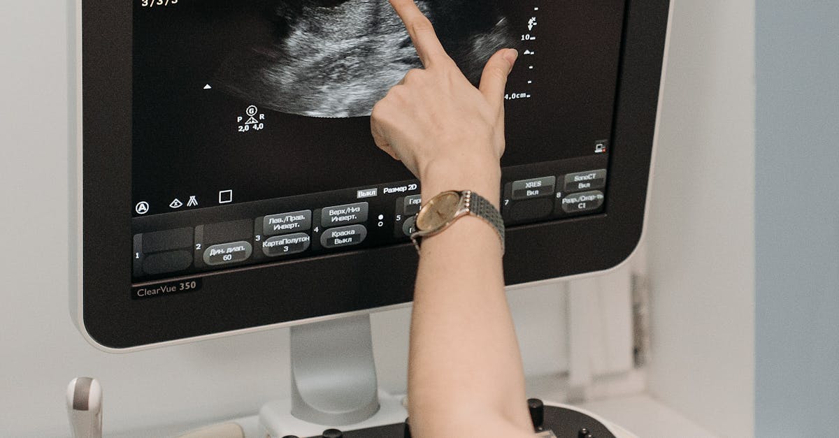 Accesibilitate sporită: radiografii gratuite la Spitalul de Urgență Târgu Mureș