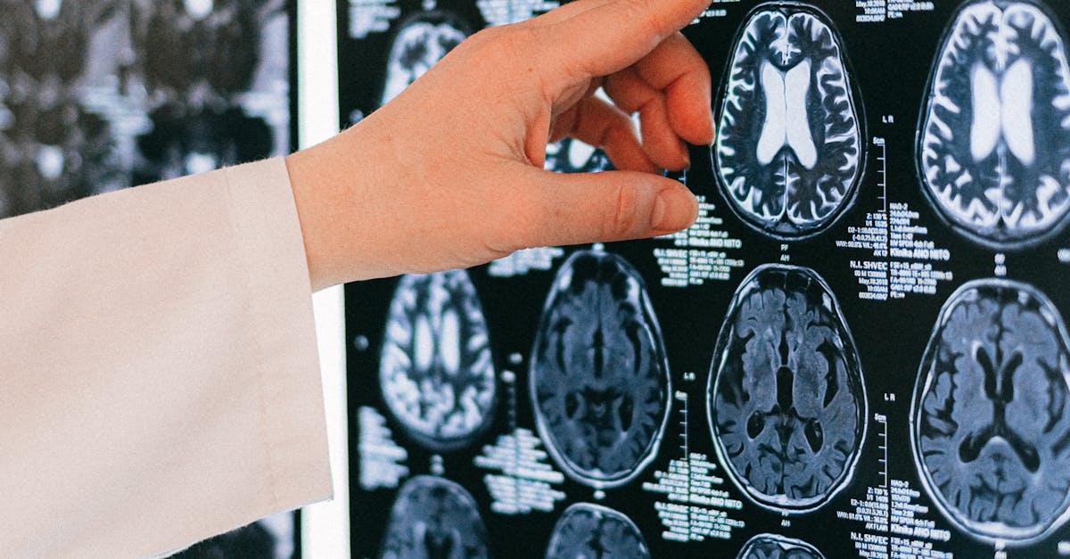 Noua structură a Spitalului Clinic de Psihiatrie și Neurologie: ce schimbări au fost aprobate
