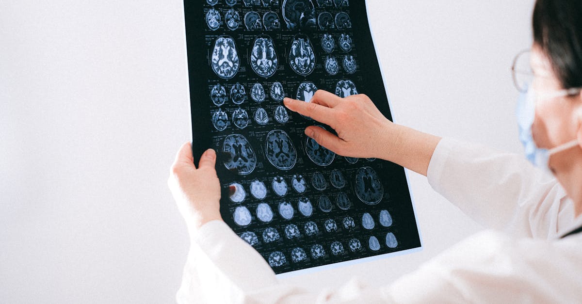 De ce femeile sunt mai afectate de Alzheimer decât bărbații? Răspunsurile cercetătorilor