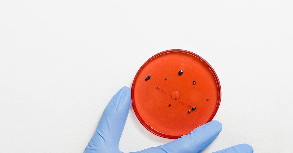 Nouă descoperire alarmantă: superbacteriile devin rezistente la antibioticele existente
