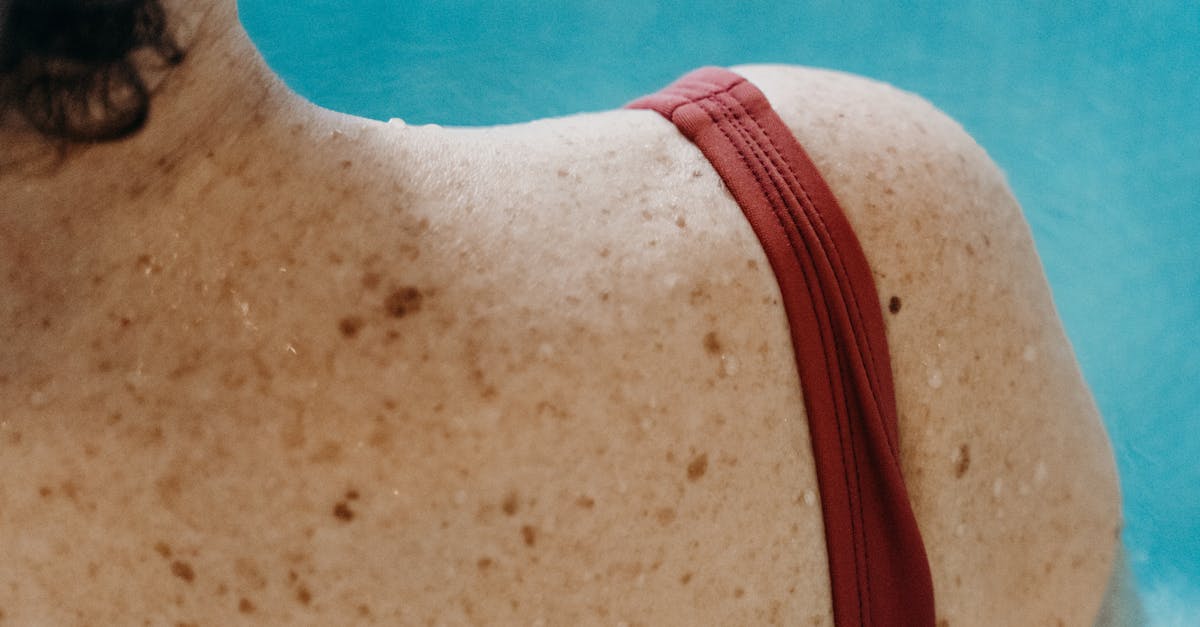 Atenție la sănătate: riscurile infecțiilor vara, mai ales la piscină