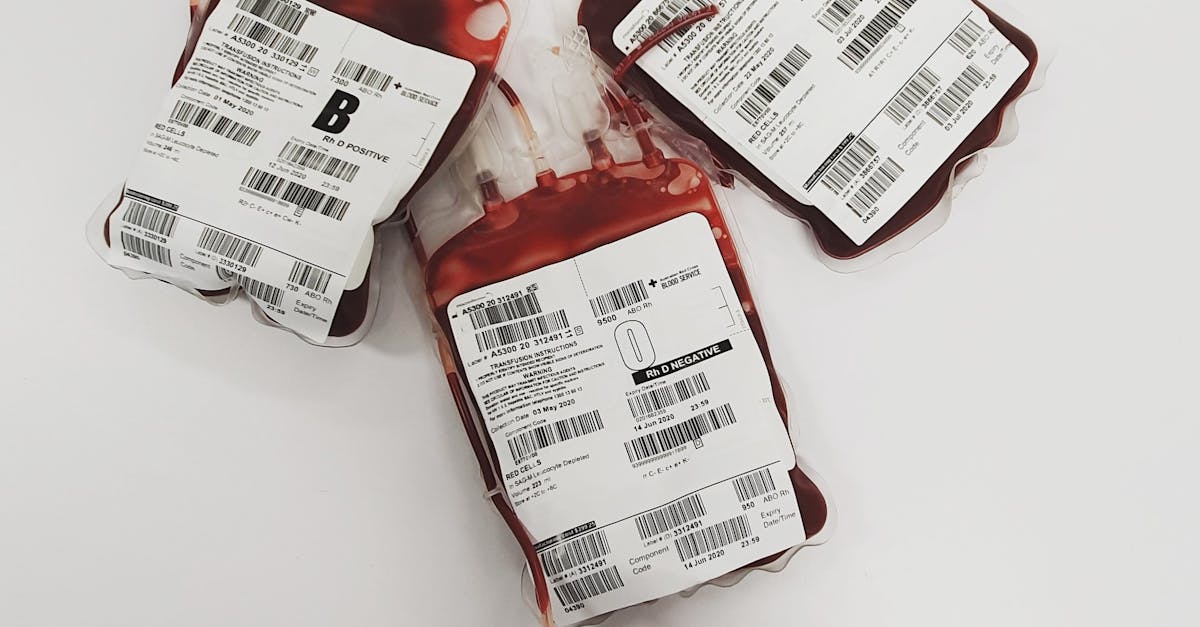 Patru pacienți au primit o nouă viață prin transplant renal în Iași