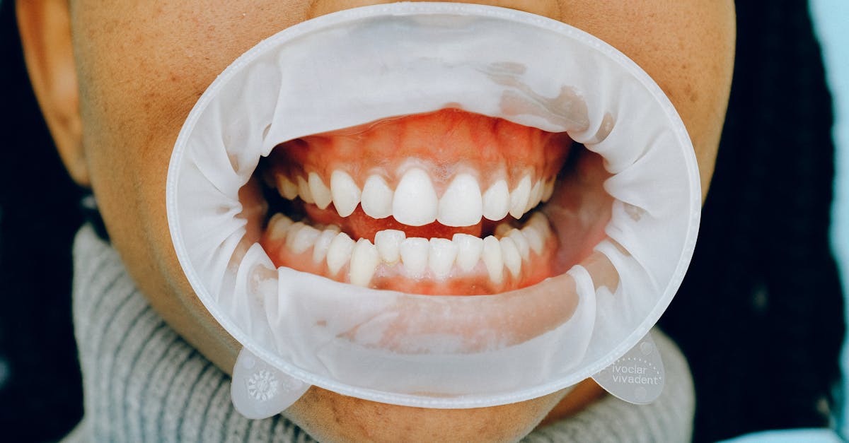10 tratamente stomatologice esențiale pentru o sănătate orală optimă