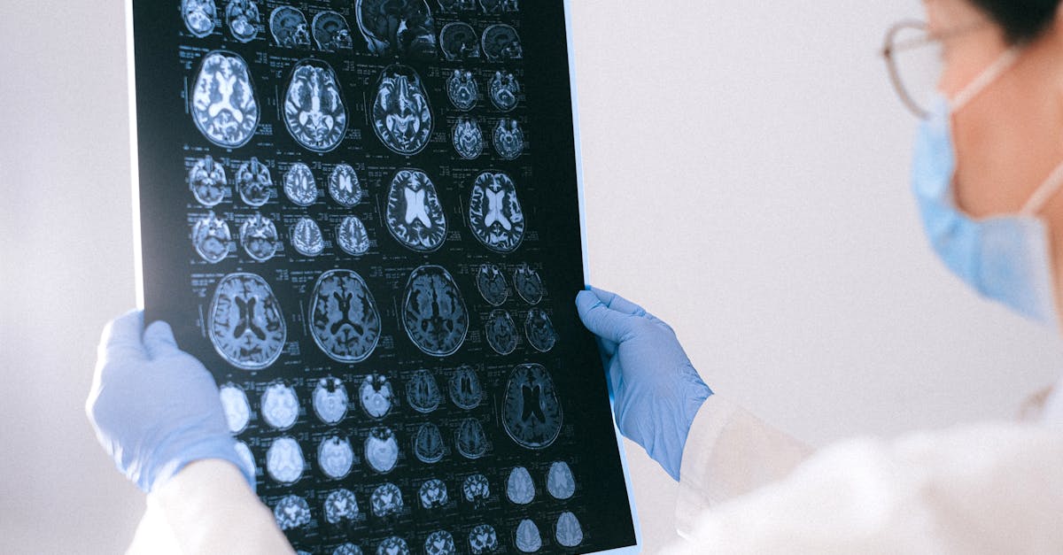 Descoperire surprinzătoare: Litiul ar putea încetini progresia bolii Alzheimer