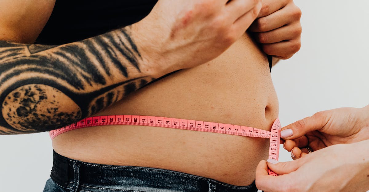 Obezitatea: o problemă cronică care necesită intervenție medicală specializată