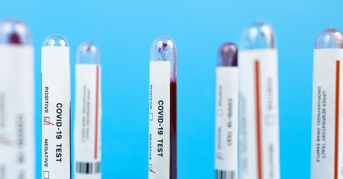 Descoperire revoluționară: testul care dezvăluie vârsta biologică a organelor dintr-o simplă analiză de sânge