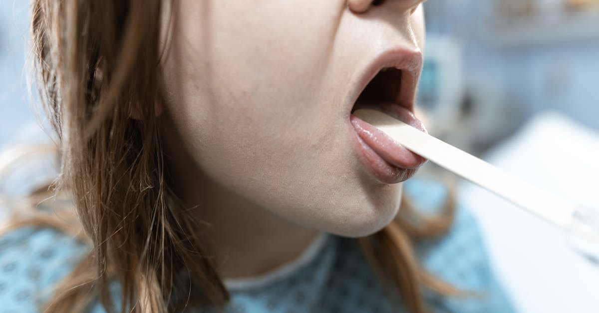 Tusea după masă: un semn al refluxului tăcut care nu trebuie ignorat