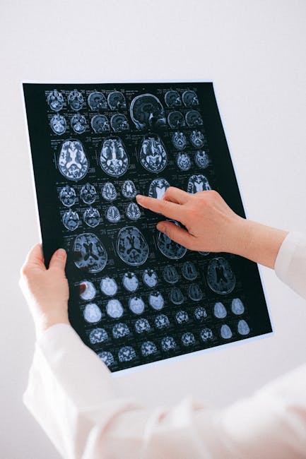 Întâlnire medicală la Târgu Jiu: Înțelegerea accidentului vascular cerebral