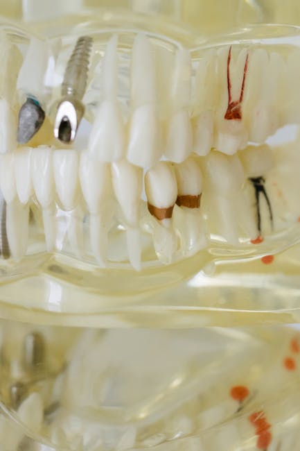 Implantul dentar: Tot ce trebuie să știi despre mituri și realitate