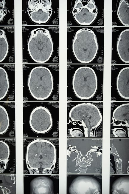 Cum atacă anticorpii creierul și care sunt simptomele alarmante