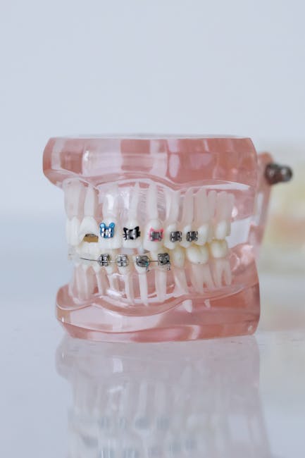 Aparatele dentare false: un trend riscant pe TikTok care îngrijorează medicii