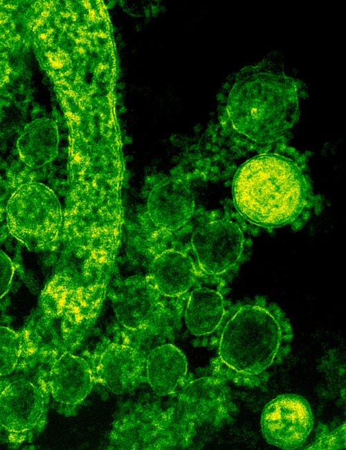 Creșterea alarmantă a cazurilor de West Nile în Grecia: 45 de noi infecții într-o săptămână