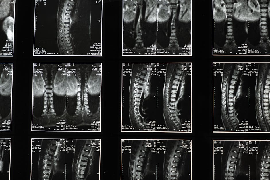 Consult de neurochirurgie: oportunitate unică la Cabinetul Dr. Coica