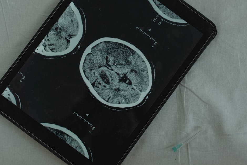 Studii recente dezvăluie legătura dintre tulburările de somn și modificările cerebrale