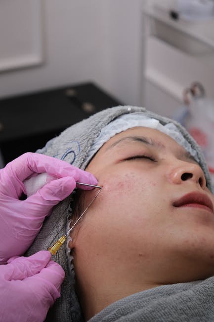 Revoluția microneedling-ului: cum îți poți transforma tenul fără durere