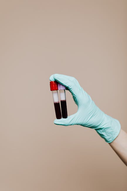 Testare rapidă pentru hepatita C la Spitalul Clinic CFR Timișoara: rezultatele în doar 15 minute