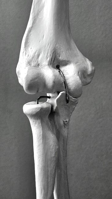 Descoperirea uimitoare a reconstrucției ligamentelor: tendonul devine ligament