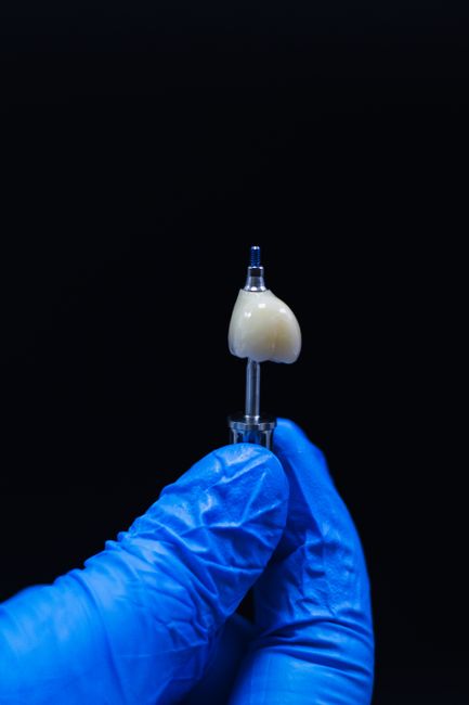 Obține o coroană dentară în aceeași zi: descoperă tehnologia CEREC