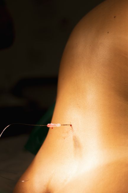 Inovații în terapia durerii la CLINICUM Oradea: soluții personalizate pentru pacienți