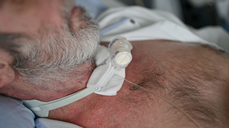 Adevăruri esențiale despre traheostomie: ce trebuie să știi